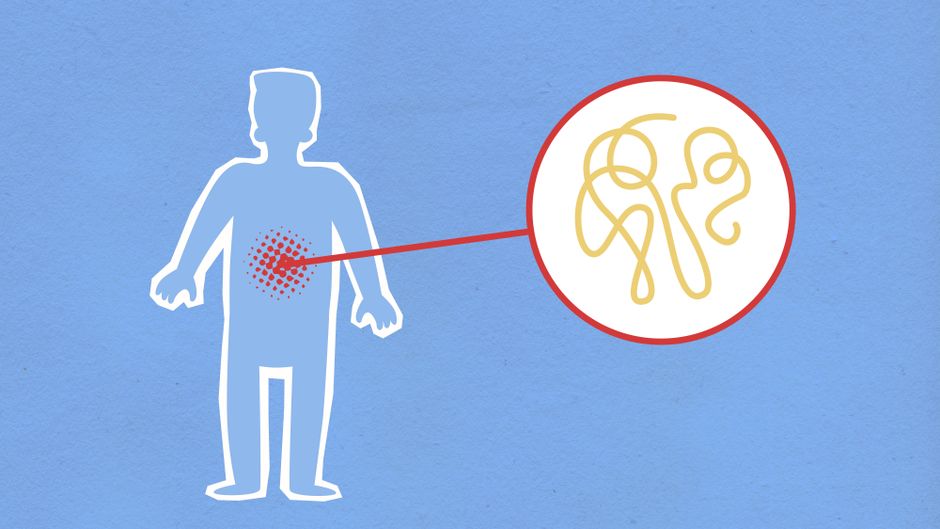 Quel lien y a-t-il entre l’Helicobacter Pylori et la prise de poids ?